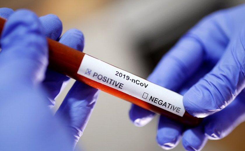 В Никополе зарегистрировали три новых пациента с коронавирусом
